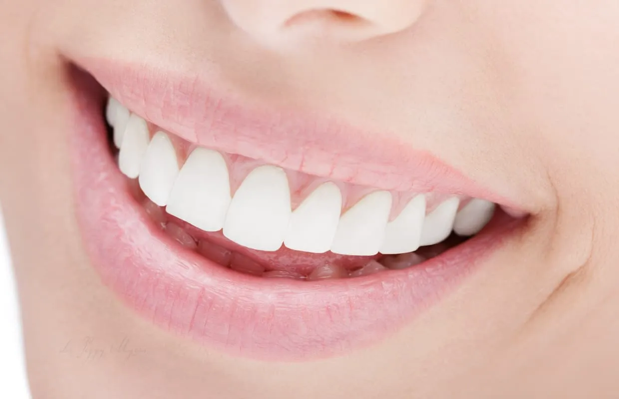 Close-up of a bright smile after cosmetic dentistry by Dr. Taylor Field, Phoenix AZ cosmetic dentist