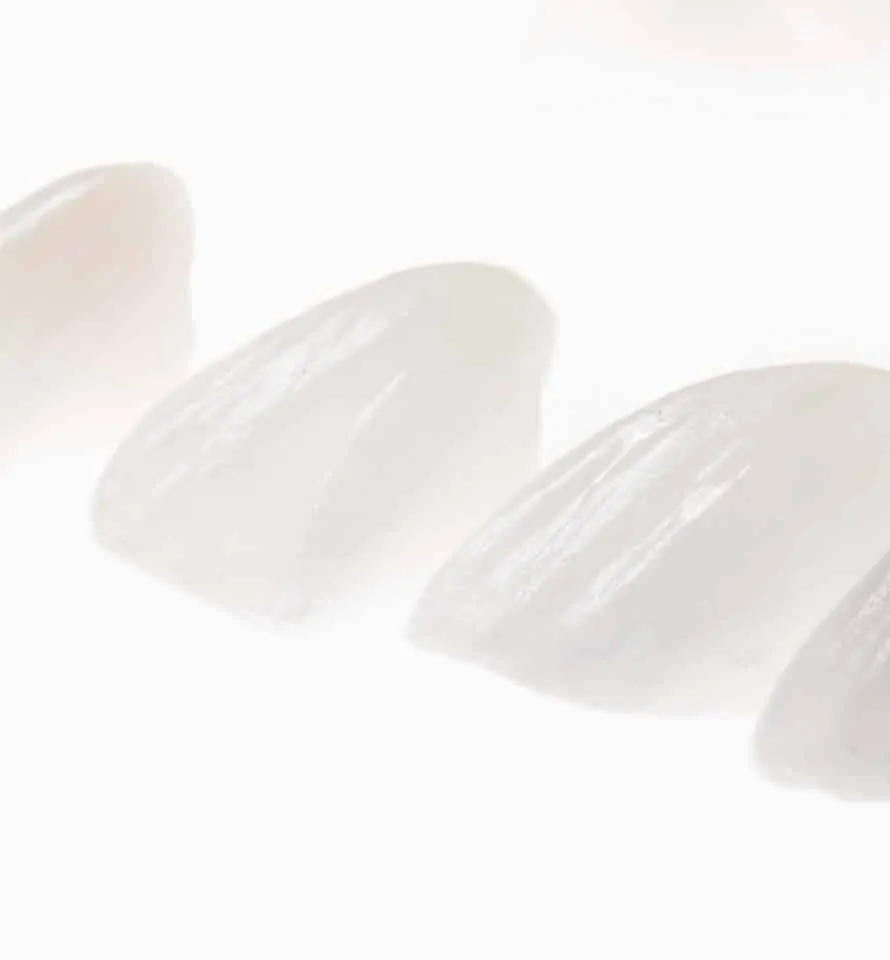 Porcelain veneers for cosmetic dentistry in Phoenix AZ by Dr. Taylor Field at Sonoran Dental Arts
